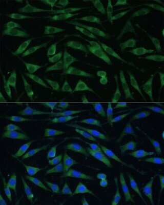 Immunocytochemistry/ Immunofluorescence: Dynamin 3 Antibody - Azide and BSA Free [NBP2-92627]