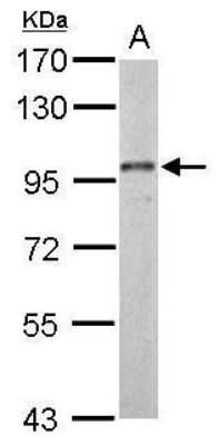 Western Blot: Dynamin 3 Antibody [NBP2-42836]