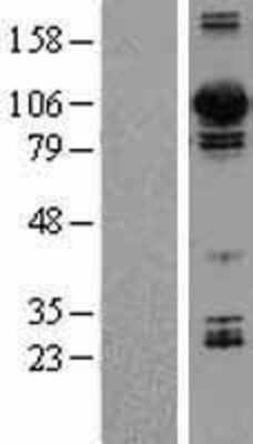 Western Blot: Dynamin 3 Overexpression Lysate [NBL1-09969]