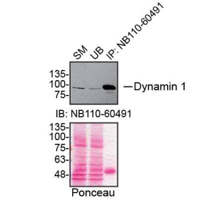 Immunoprecipitation: Dynamin Antibody (3G4B6) [NB110-60491]
