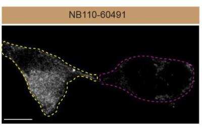 Knockout Validated: Dynamin Antibody (3G4B6) [NB110-60491]