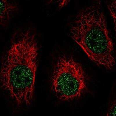 Immunocytochemistry/ Immunofluorescence: Dynamin Antibody [NBP2-76558]