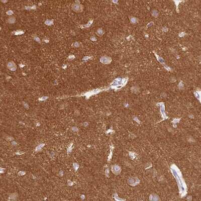 Immunohistochemistry-Paraffin: Dynamin Antibody [NBP2-48950]