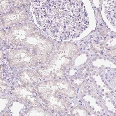 Immunohistochemistry-Paraffin: Dynamin Antibody [NBP2-48950]