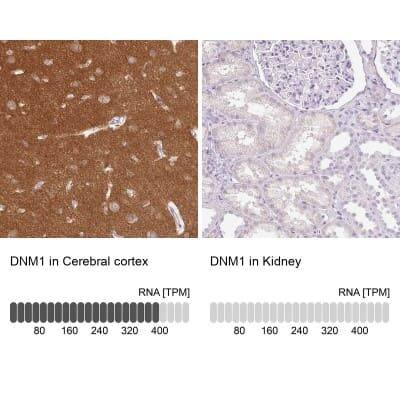 Immunohistochemistry-Paraffin: Dynamin Antibody [NBP2-48950]