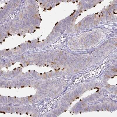 Immunohistochemistry-Paraffin: Dynein heavy chain Antibody [NBP2-38671]