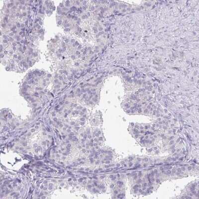Immunohistochemistry-Paraffin: Dynein heavy chain Antibody [NBP2-38671]