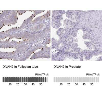 Immunohistochemistry-Paraffin: Dynein heavy chain Antibody [NBP2-38671]