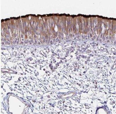 Immunohistochemistry-Paraffin: Dynein heavy chain Antibody [NBP2-38671]