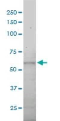 Western Blot: Dynein intermediate chain 2 Antibody (1C8) [H00064446-M01]