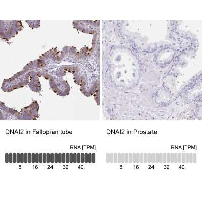 Immunohistochemistry-Paraffin: Dynein intermediate chain 2 Antibody [NBP2-37927]