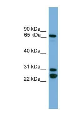 Western Blot: Dynein intermediate chain 2 Antibody [NBP1-80509]