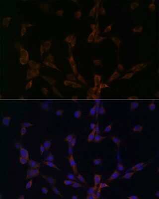 Immunocytochemistry/ Immunofluorescence: Dynein light chain 2 cytoplasmic Antibody - Azide and BSA Free [NBP2-92136]