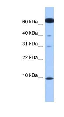 Western Blot: Dynein light chain 2 cytoplasmic Antibody [NBP1-54377]