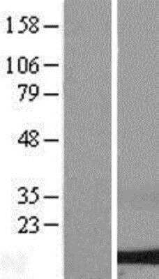 Western Blot: Dynein light chain 2 cytoplasmic Overexpression Lysate [NBL1-10071]