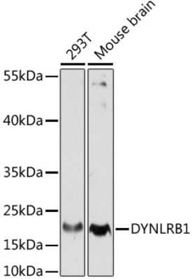 Western Blot: Dynein light chain 2a cytoplasmic AntibodyAzide and BSA Free [NBP2-92214]