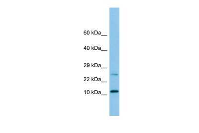 Western Blot: Dynein light chain 2a cytoplasmic Antibody [NBP3-10682]