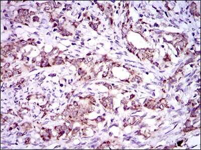 Immunohistochemistry: Dynein light chain 4 Antibody (3C10A4) - BSA Free [NBP2-37389]