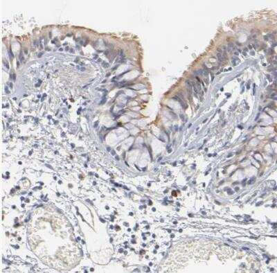 Immunohistochemistry-Paraffin: Dynein light chain 4 Antibody [NBP1-84227]