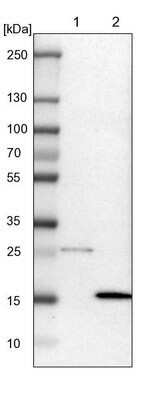 Western Blot: Dynein light chain 4 Antibody [NBP1-84227]