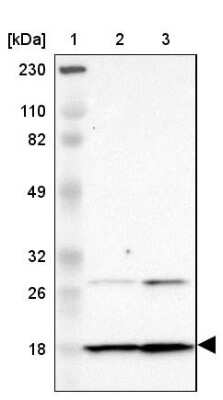 Western Blot: Dynein light chain 4 Antibody [NBP1-84227]