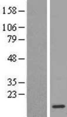 Western Blot: Dynein light chain 4 Overexpression Lysate [NBL1-09958]