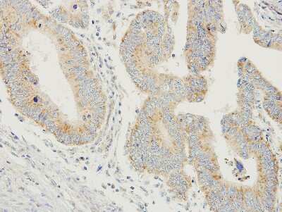 Immunohistochemistry-Paraffin: Prodynorphin/PDYN Antibody [NBP1-31768]