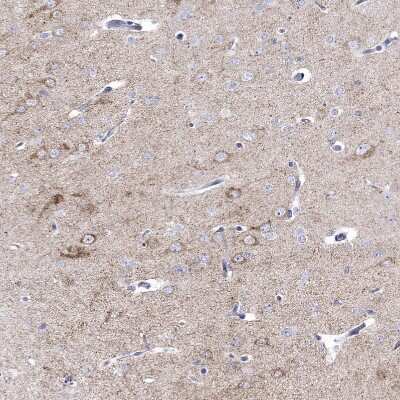 Immunohistochemistry-Paraffin: Prodynorphin/PDYN Antibody [NBP2-49081]