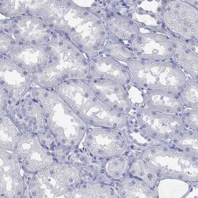 Immunohistochemistry-Paraffin: Prodynorphin/PDYN Antibody [NBP2-49081]