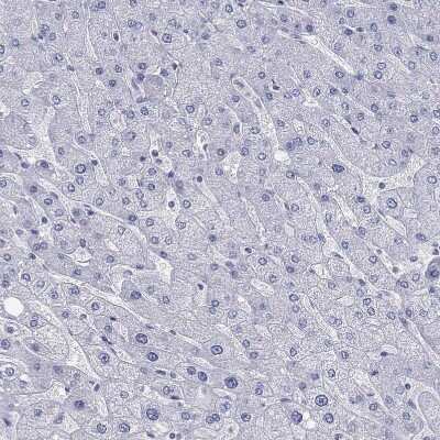 Immunohistochemistry-Paraffin: Prodynorphin/PDYN Antibody [NBP2-49081]
