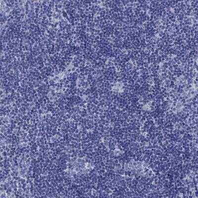 Immunohistochemistry-Paraffin: Prodynorphin/PDYN Antibody [NBP2-49081]