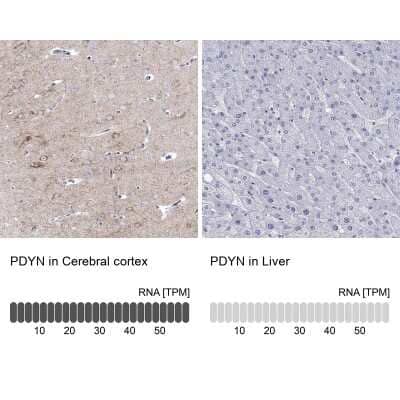 Immunohistochemistry-Paraffin: Prodynorphin/PDYN Antibody [NBP2-49081]