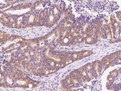 Immunohistochemistry-Paraffin: Prodynorphin/PDYN Antibody [NBP2-99140]