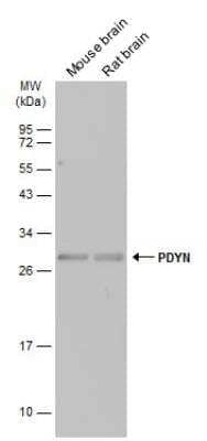 Western Blot: Prodynorphin/PDYN Antibody [NBP1-31768]