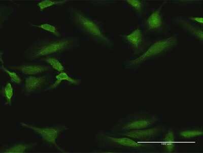 Immunocytochemistry/ Immunofluorescence: Dyrk1B Antibody [H00009149-D01P]
