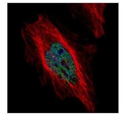 Immunocytochemistry/ Immunofluorescence: Dyrk1B Antibody [NBP1-33464]