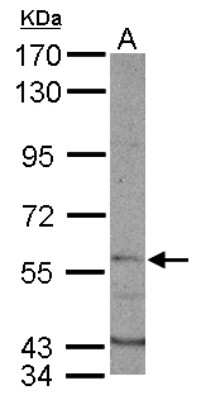 Western Blot: Dyrk1B Antibody [NBP1-33464]