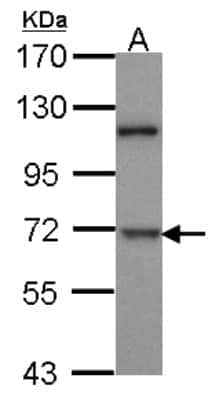 Western Blot: Dyrk1B Antibody [NBP1-33464]