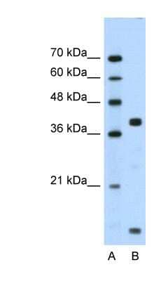 Western Blot: FXYD5/Dysadherin Antibody [NBP1-59137]