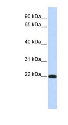 Western Blot: FXYD5/Dysadherin Antibody [NBP1-59138]