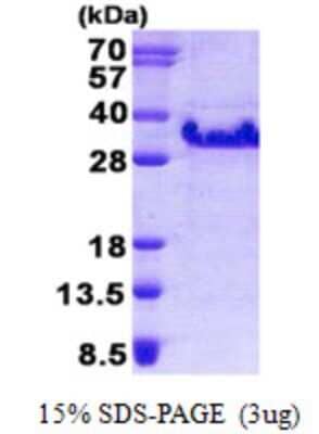 SDS-PAGE: Recombinant Human FXYD5/Dysadherin His Protein [NBP2-23064]