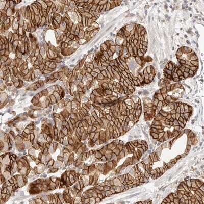Immunohistochemistry-Paraffin: Dysbindin Antibody [NBP1-85298]