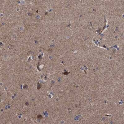 Immunohistochemistry-Paraffin: Dysbindin Antibody [NBP1-85299]