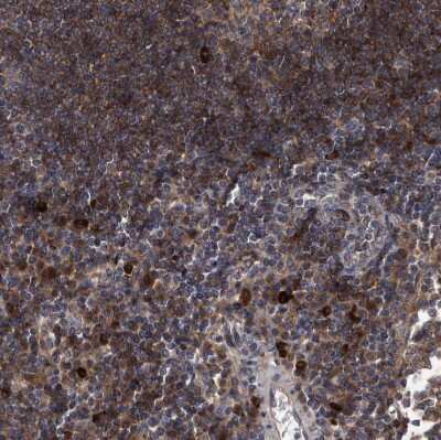 Immunohistochemistry-Paraffin: Dysbindin Antibody [NBP1-85299]