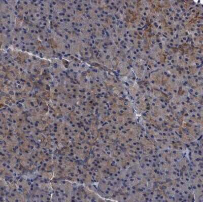 Immunohistochemistry-Paraffin: Dysbindin Antibody [NBP1-85299]