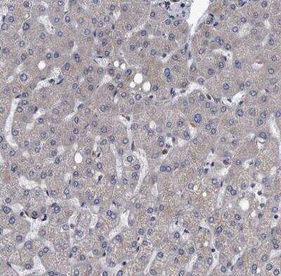 Immunohistochemistry-Paraffin: Dysbindin Antibody [NBP1-85299]