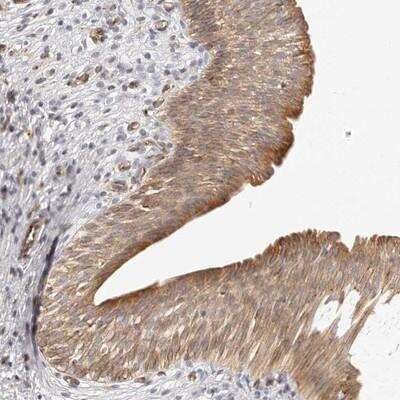Immunohistochemistry-Paraffin: Dysbindin Antibody [NBP1-85300]