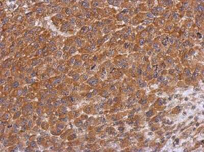 Immunohistochemistry-Paraffin: Dysbindin Antibody [NBP2-16245]