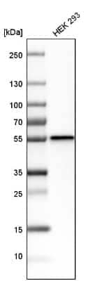 Western Blot: Dysbindin Antibody [NBP1-85298]