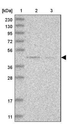 Western Blot: Dysbindin Antibody [NBP1-85299]